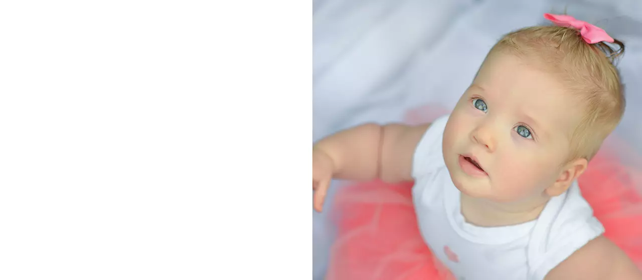 Халязион у детей