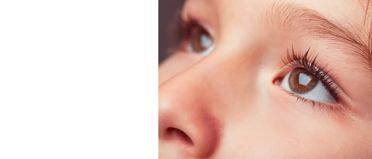 Увеит у детей