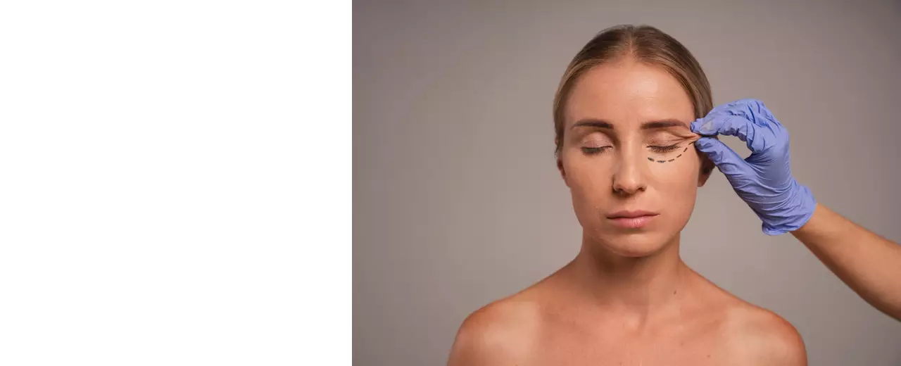 Устранение птоза век