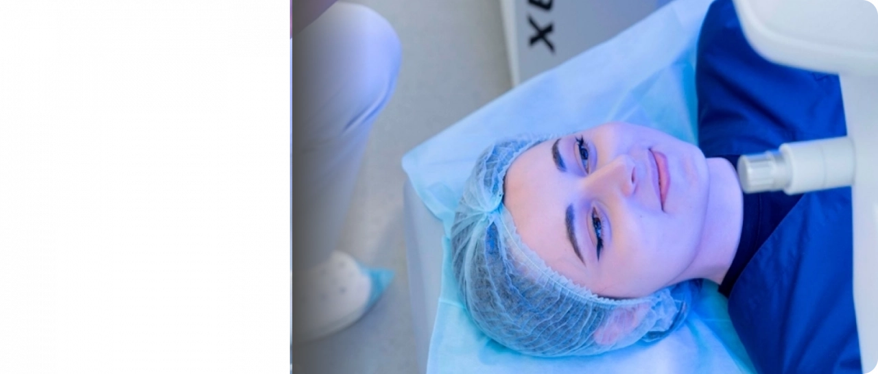 Коррекция зрения методом Smile
