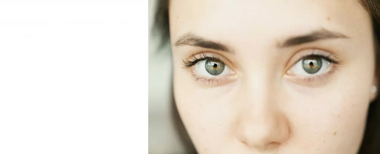 Флуоресцентная ангиография (ФАГ)