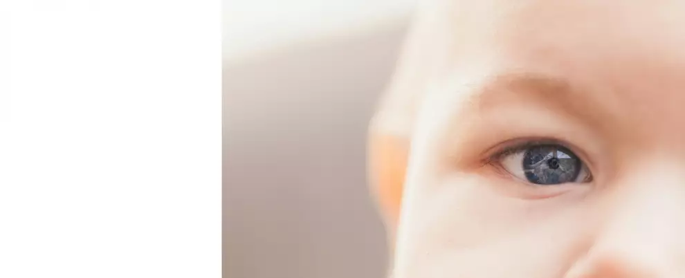 Блефарит у детей