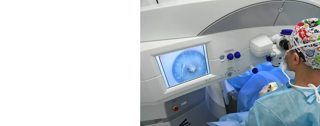 Коррекция зрения методом Smile