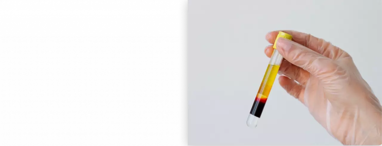 Интравитреальные инъекции и манипуляции