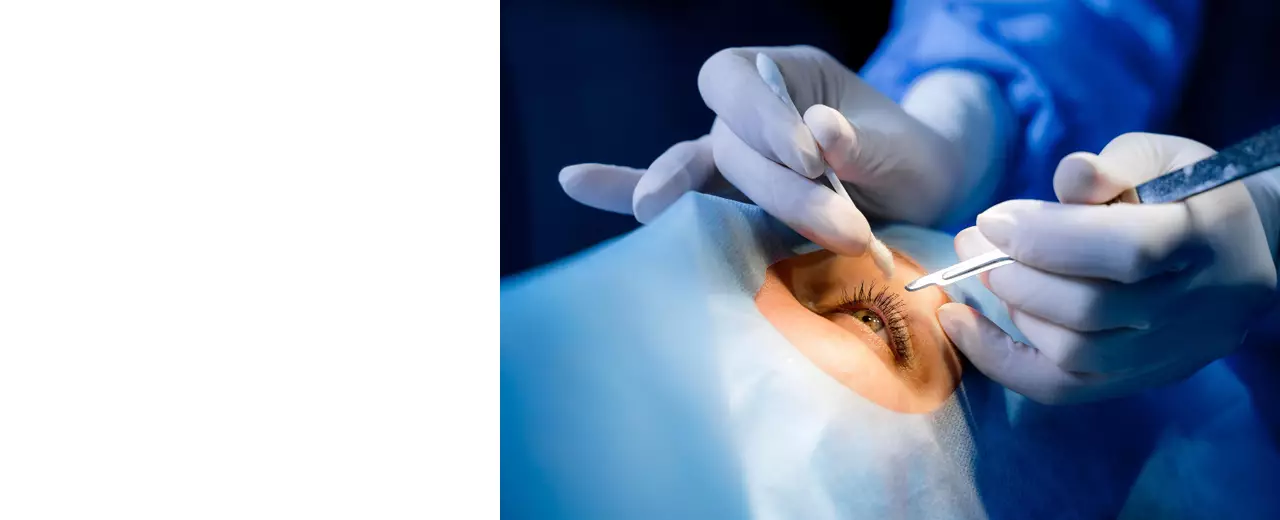 Ревизия витреальной полости