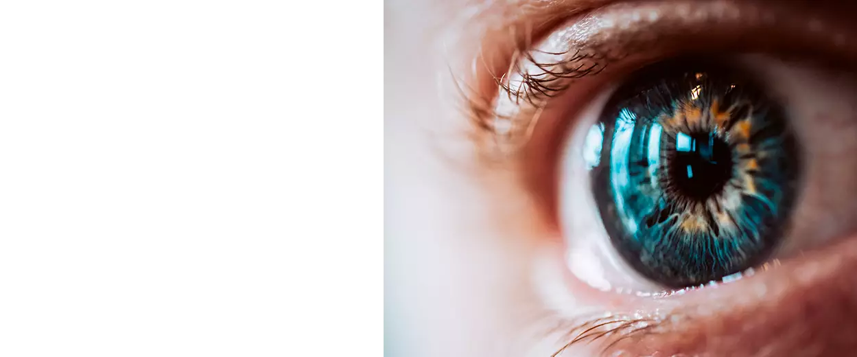 Блефаропластика век