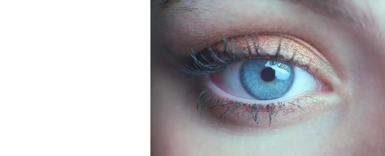 Пластика слезной точки