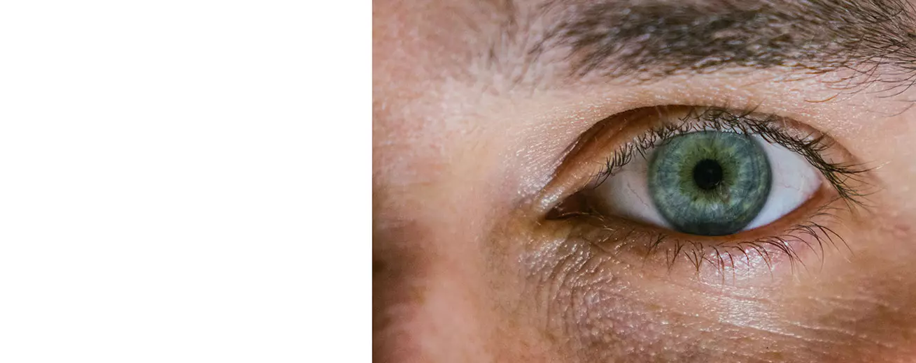 Периметрия глаз