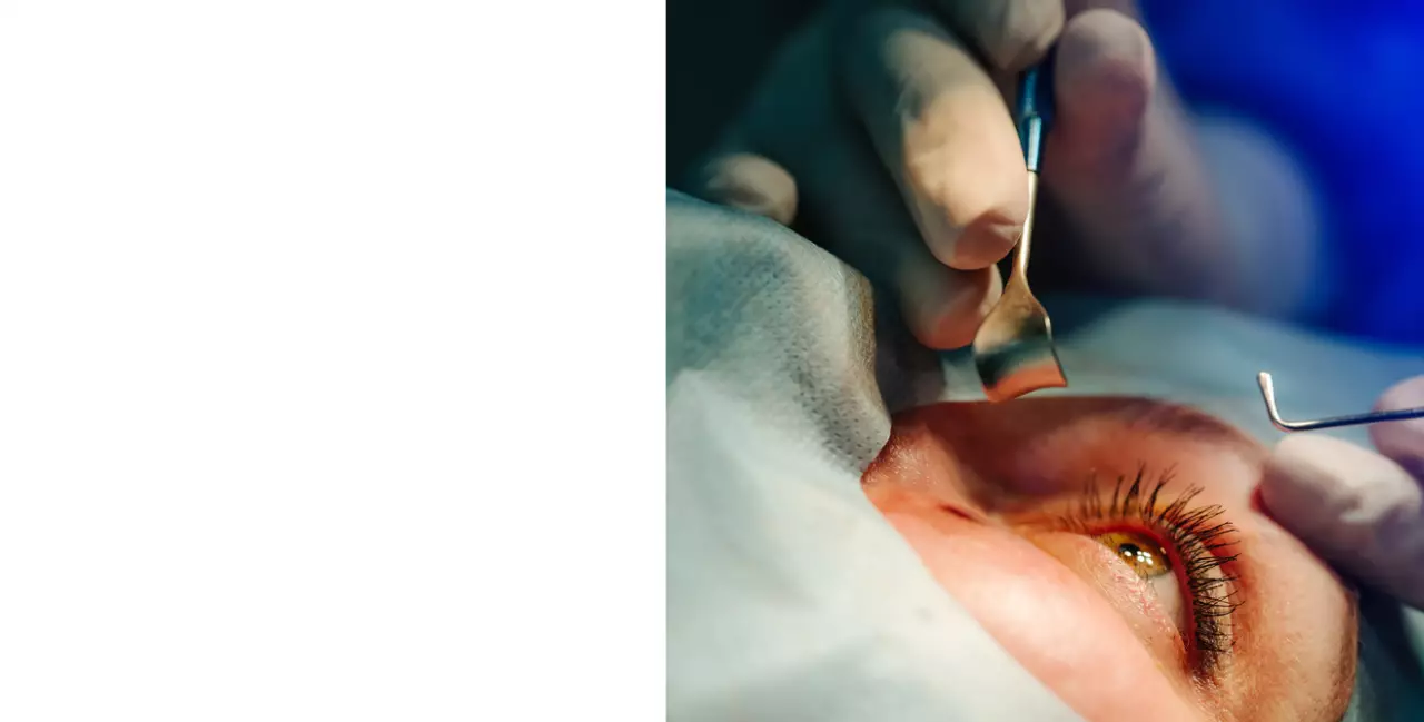 Хирургическое лечение заболеваний глаз