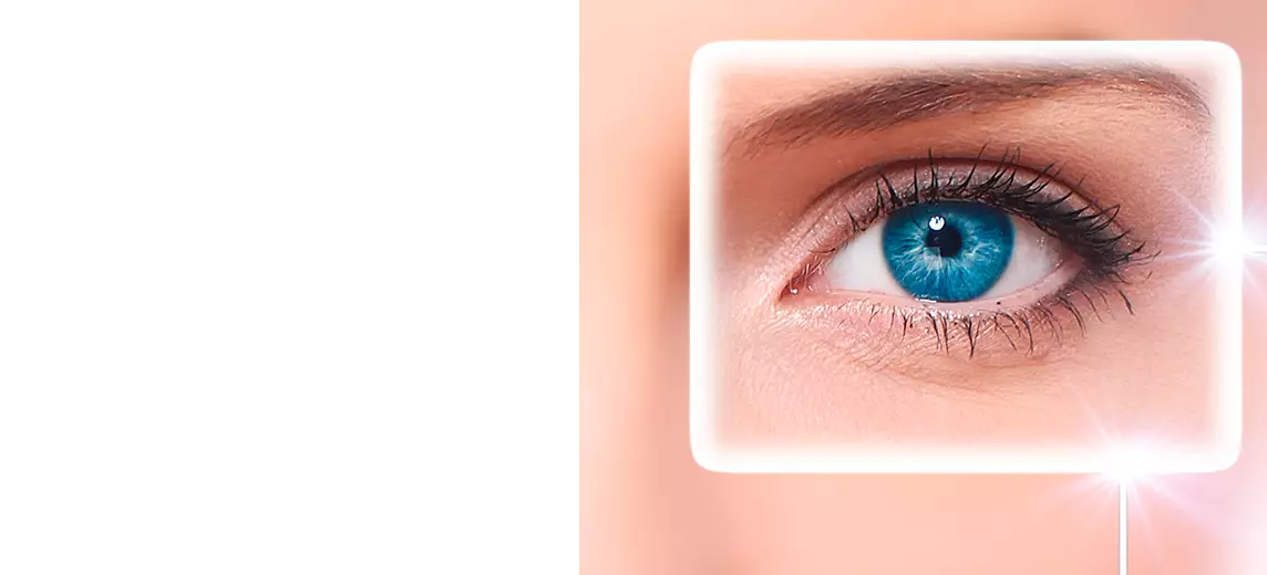 Лазерная коррекция зрения