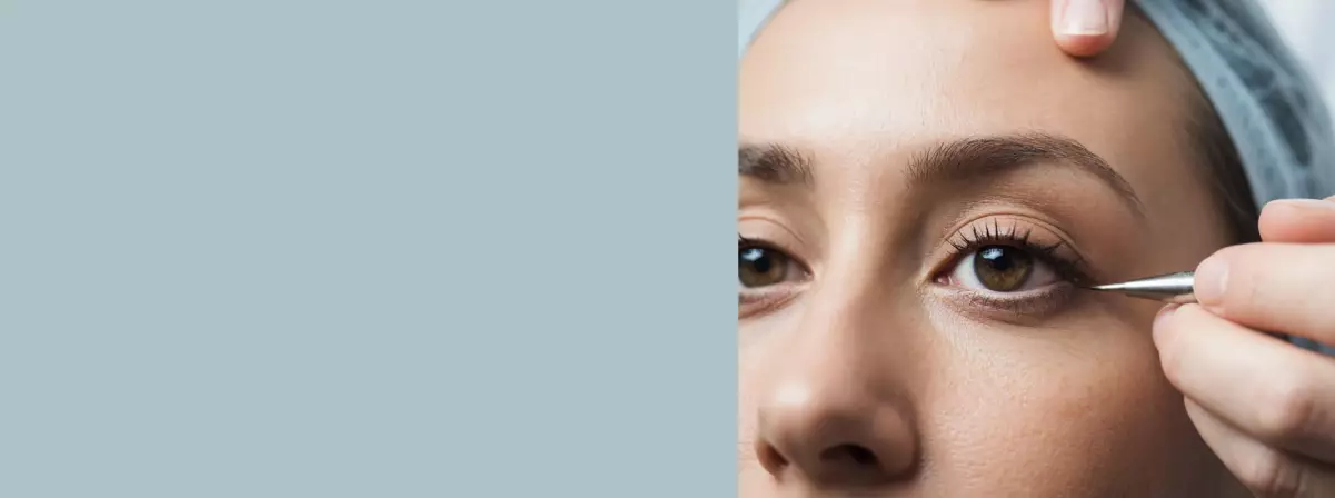 Блефаропластика нижних век