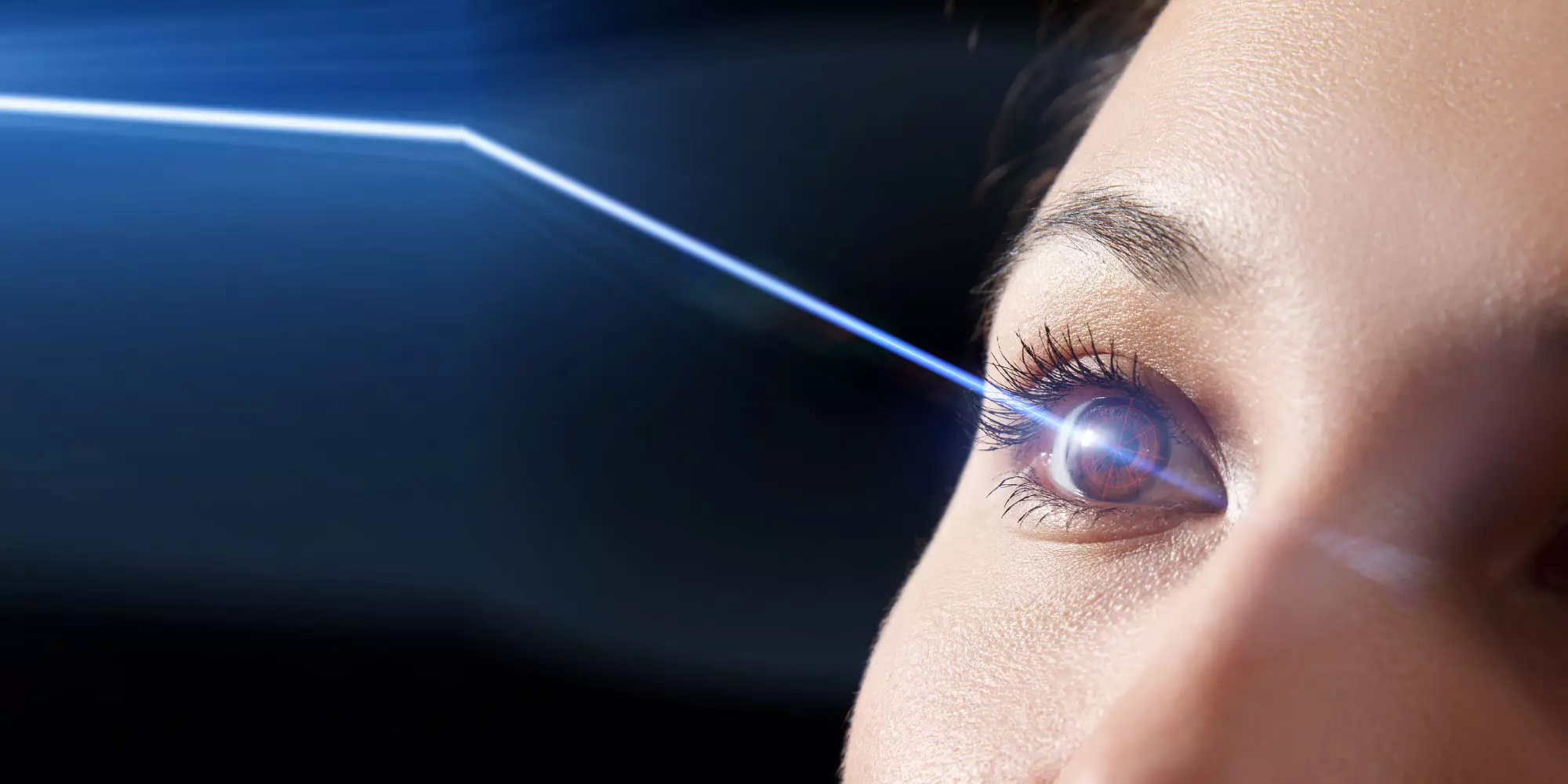 Лентикулярная хирургия