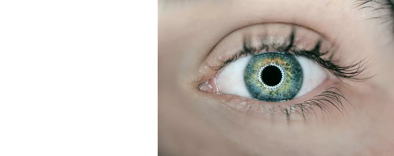 Биометрия глаз