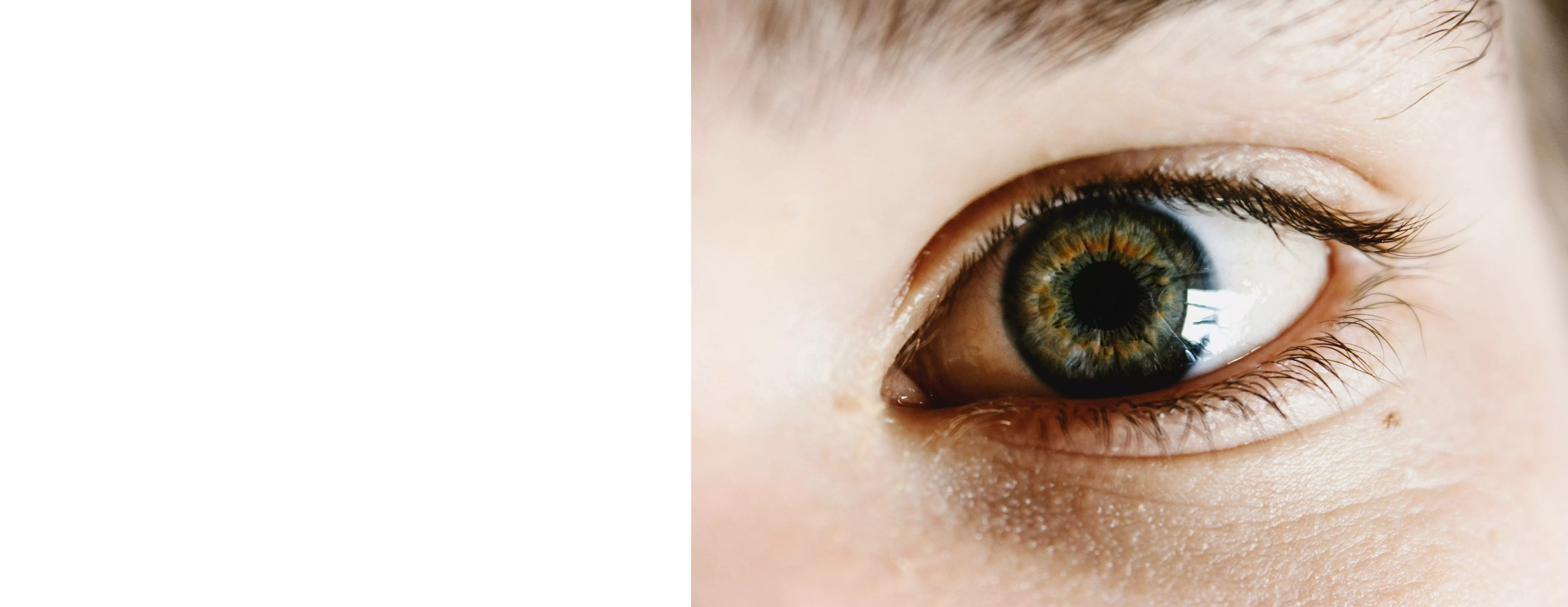 Кератит у детей